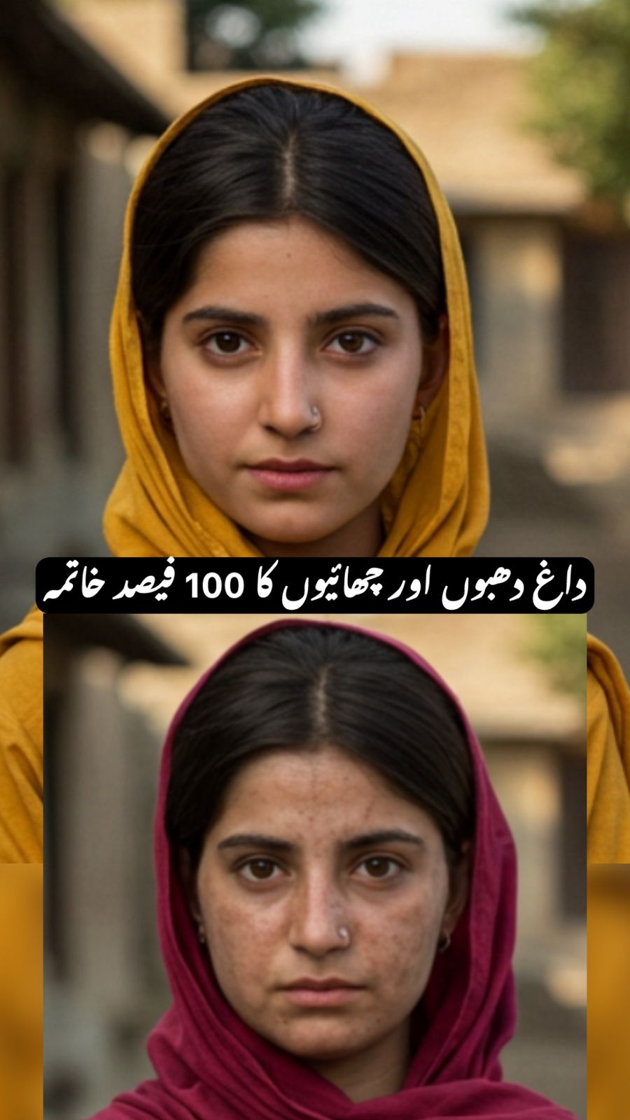 Vital gulta pigment reducer cream 