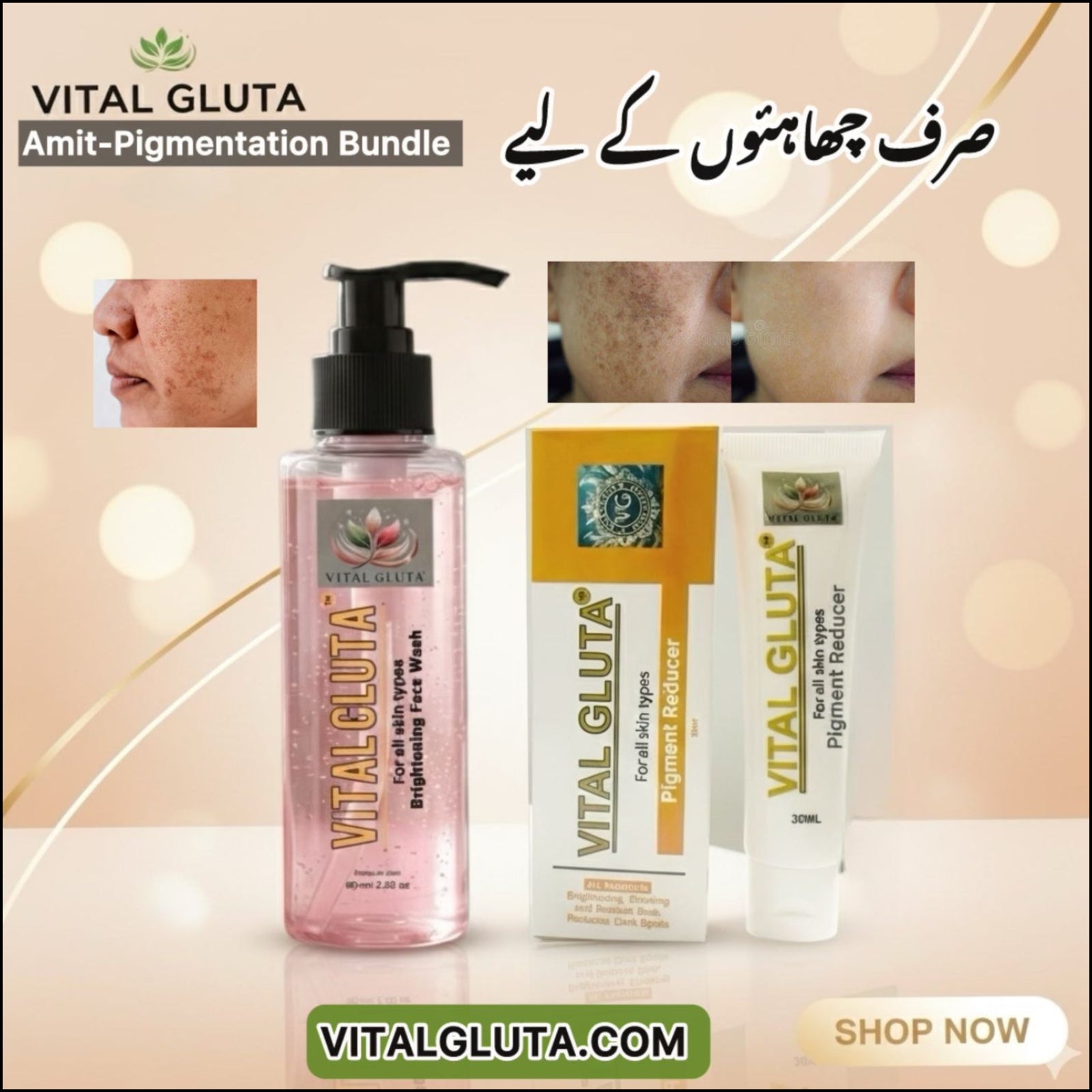 Anti - Pigmentation bundle Vital Gluta 30ml Pigment Reducer Cream & 100ml Vital Gluta Brightening FaceWash - Vital Gluta